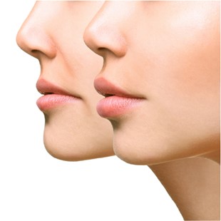 همه چیز درباره سانترال لب