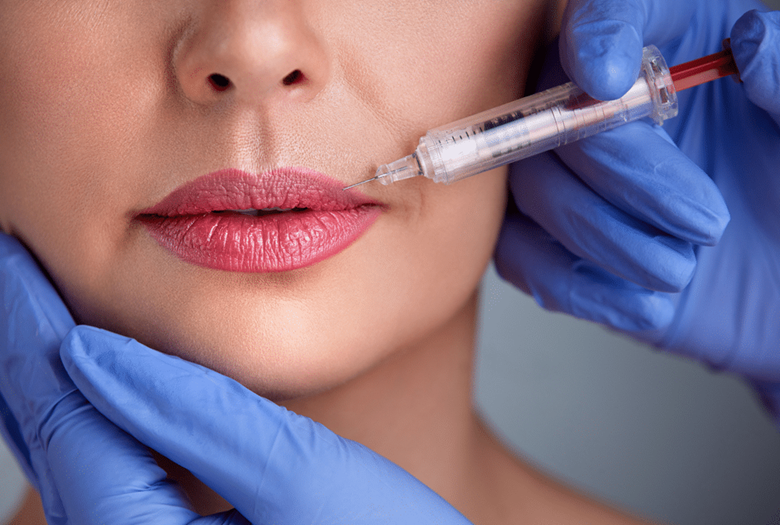 تزریق ژل لب