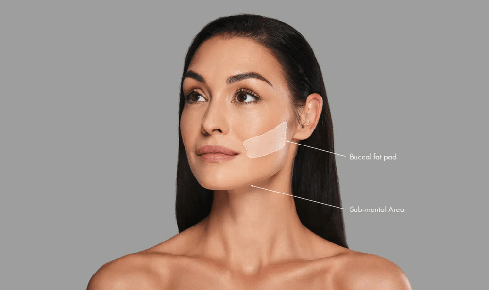 هزینه جراحی بوکال صورت به عوامل مختلفی بستگی دارد