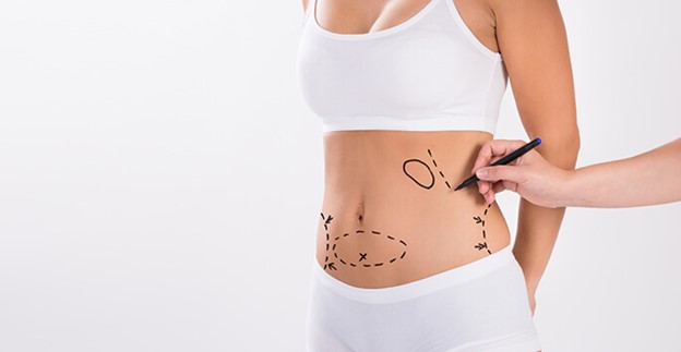 جراحی لیپوساکشن چیست؟