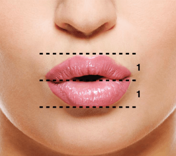 وقتی فاصله بین لب فوقانی و بینی زیاد می‌شود، نیاز به اصلاح دارد