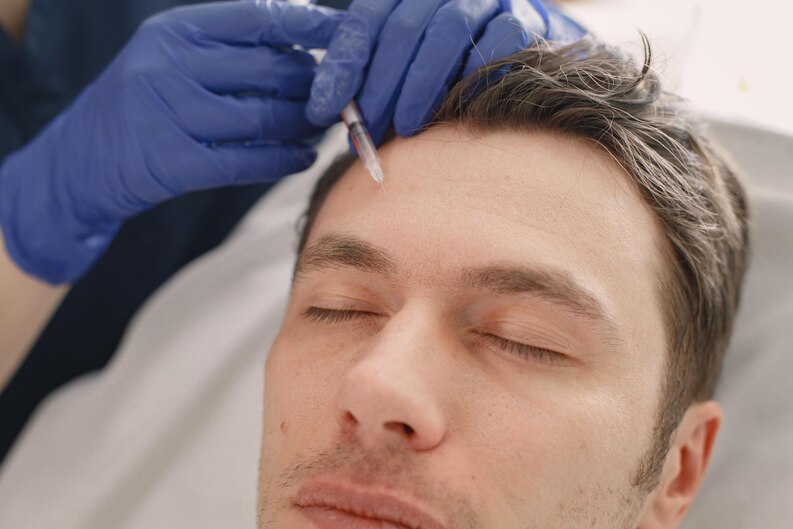 بوتاکس پیشانی مردان