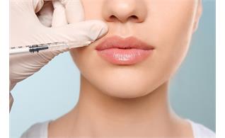 اصلاح فرم لب با تزریق ژل