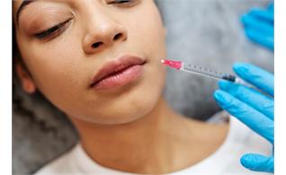 تزریق ژل لب روسی