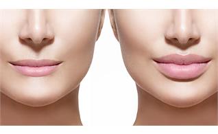 جراحی سانترال لب