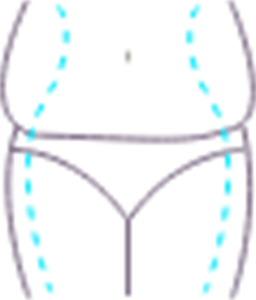 لیپوساکشن و لیپوماتیک