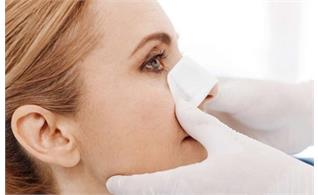 مراقبت های عمل بینی