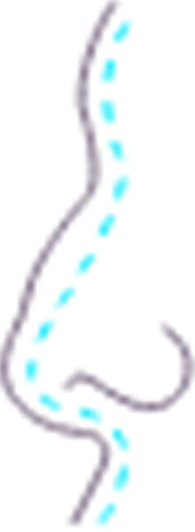 جراحی بینی (رینوپلاستی)