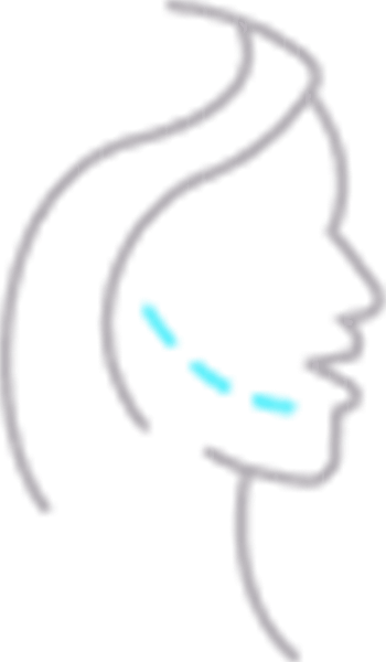 جراحی بوکال صورت