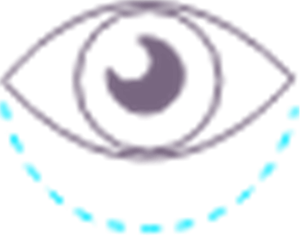 بلفاروپلاستی پلک